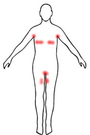hidradenitis-suppurativa-zinc
