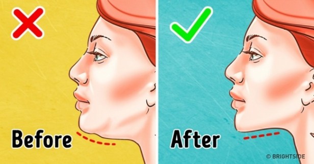 eliminate double chin