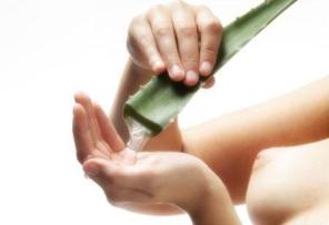 0-aloe-vera-vitiligo