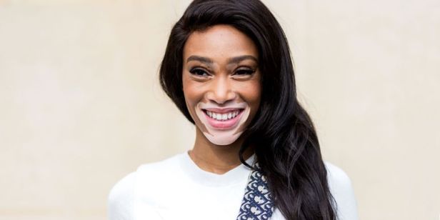 winnie-harlow-1491583480